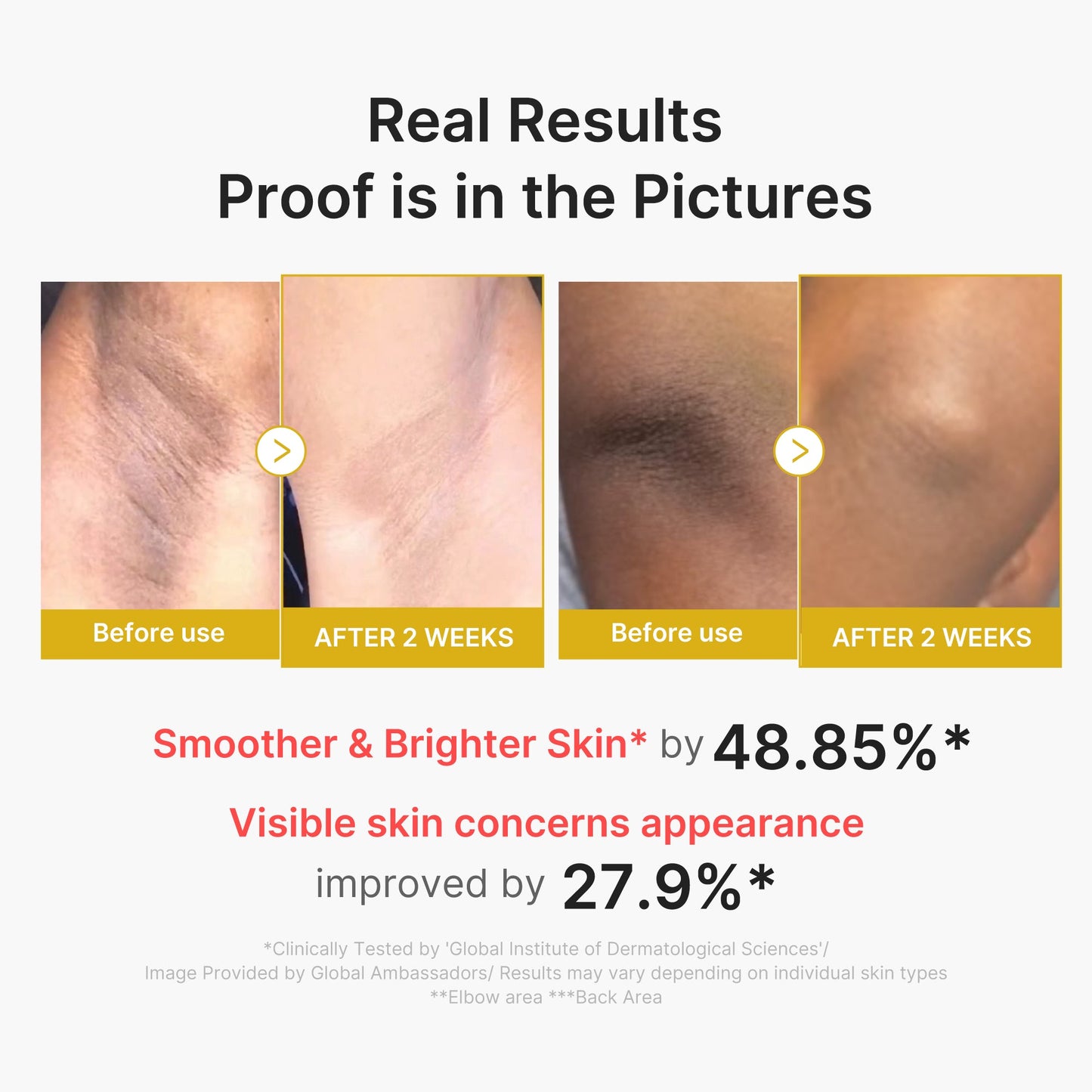 Kojic Acid Turmeric Body Peel Shot